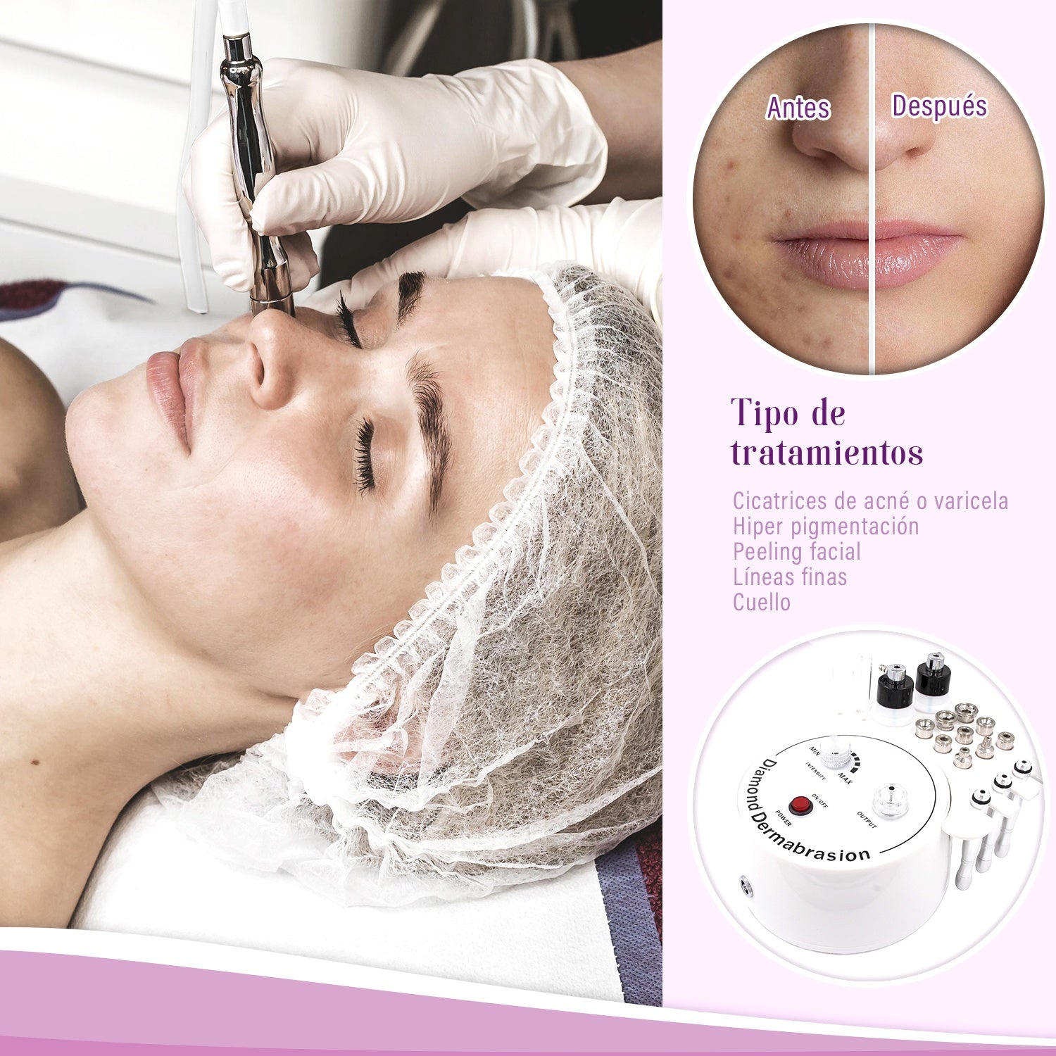 Maquina Dermoabrasion Multifuncion 3en1 Microdermo Diamond Peeling